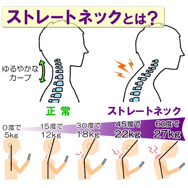 ストレートネックとは？