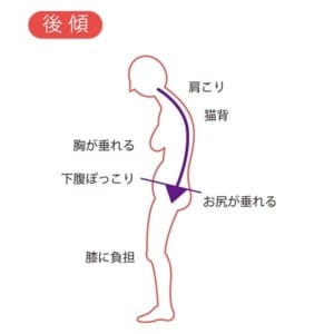 骨盤の後傾