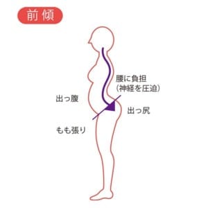 骨盤の後傾