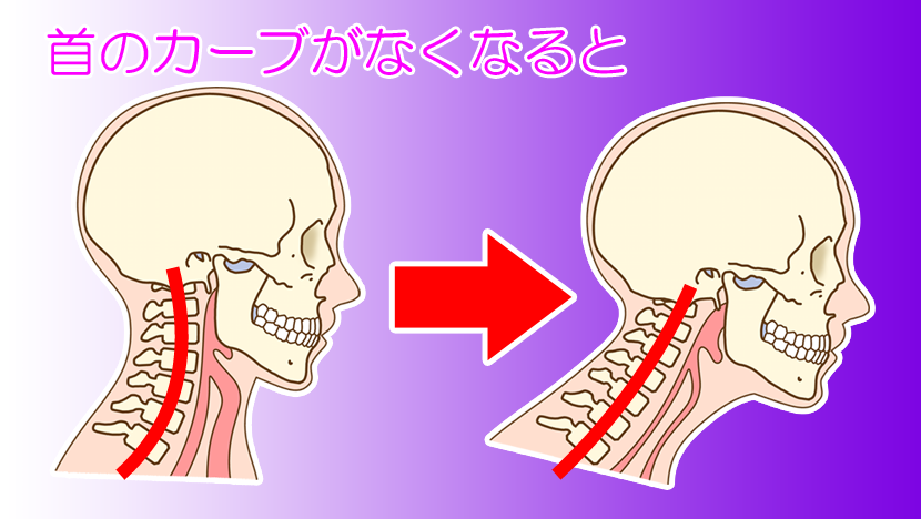 首のカーブがなくなると