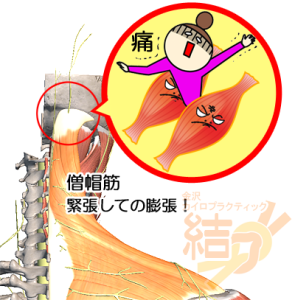 僧帽筋の緊張