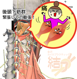 後頭下筋群の緊張
