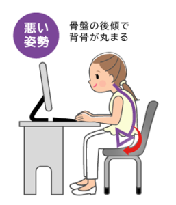 悪い姿勢①