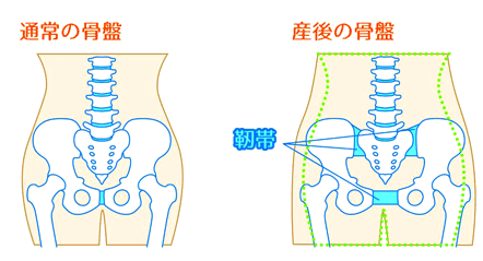 産後の骨盤